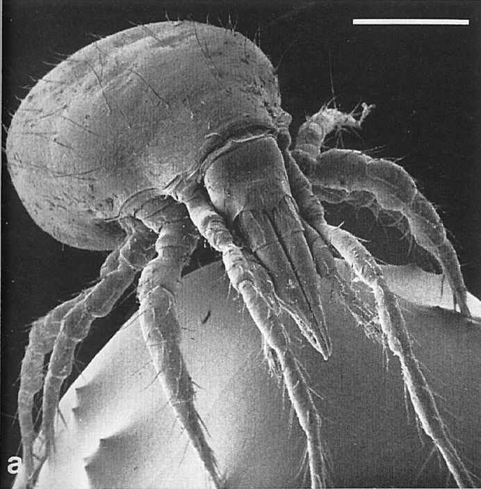 dustmites feeding on your dead skin